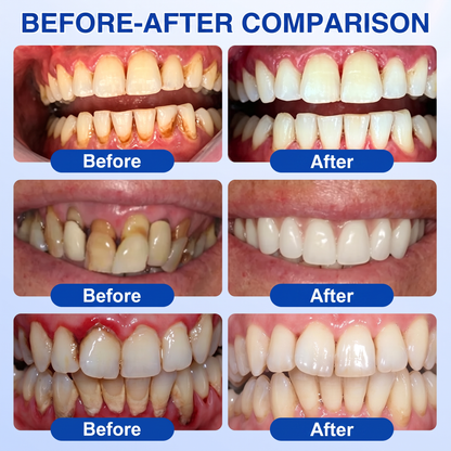 🇬🇧 Glimmerly® 🦷GumRevive periodontal repair gel💎
