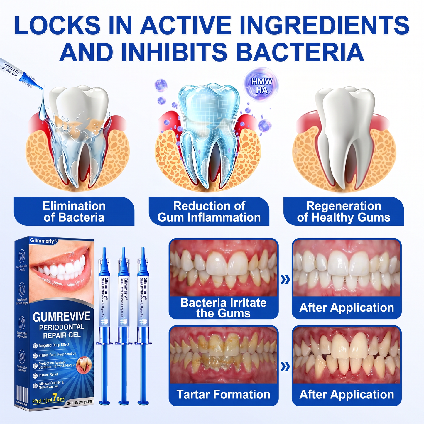 🇬🇧 Glimmerly® 🦷GumRevive periodontal repair gel💎