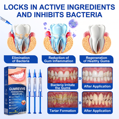 🇬🇧 Glimmerly® 🦷GumRevive periodontal repair gel💎