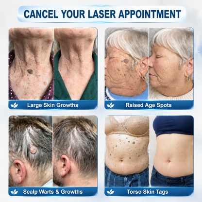 𝐎𝐟𝐟𝐢𝐜𝐢𝐚𝐥 𝐁𝐫𝐚𝐧𝐝 𝐒𝐭𝐨𝐫𝐞 |💡 𝐏i𝐜𝐝o® 7-𝐷𝑎𝑦 𝗧𝐚𝐠 & 𝗦𝗽𝐨𝐭 𝐄𝐫𝒂𝒔𝒆𝒓(Zero Pain, Zero 𝐒𝐜𝐚𝒓𝒔 Rollerball)
